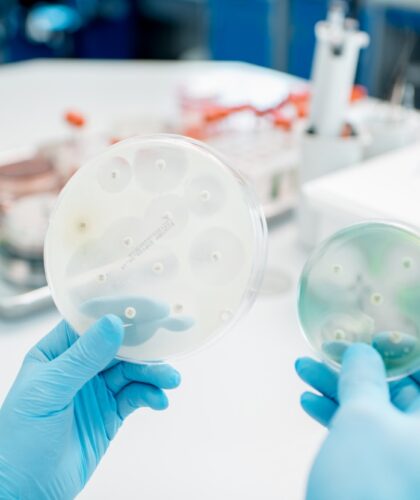 bacteria with antibiotics in petri dishes 2021 12 13 22 44 07 utc